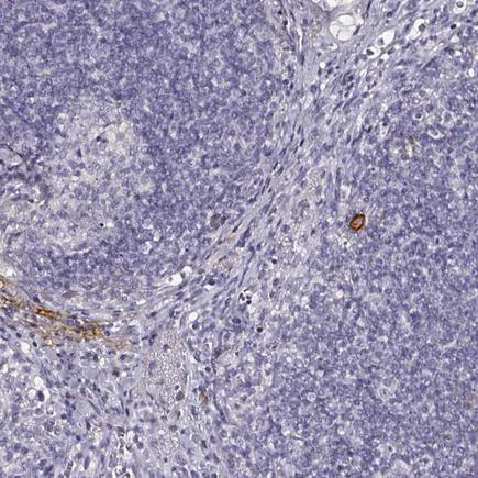 Immunohistochemistry (Formalin/PFA-fixed paraffin-embedded sections) - Anti-DPEP1/MDP antibody (AB121308)