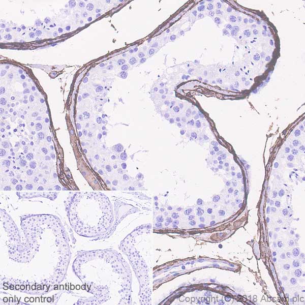 Immunohistochemistry (Formalin/PFA-fixed paraffin-embedded sections) - Anti-DPEP1/MDP antibody [EPR22222] (AB230977)