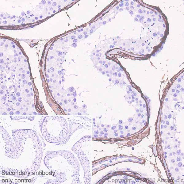 Immunohistochemistry (Formalin/PFA-fixed paraffin-embedded sections) - Anti-DPEP1/MDP antibody [EPR22222] (AB230977)