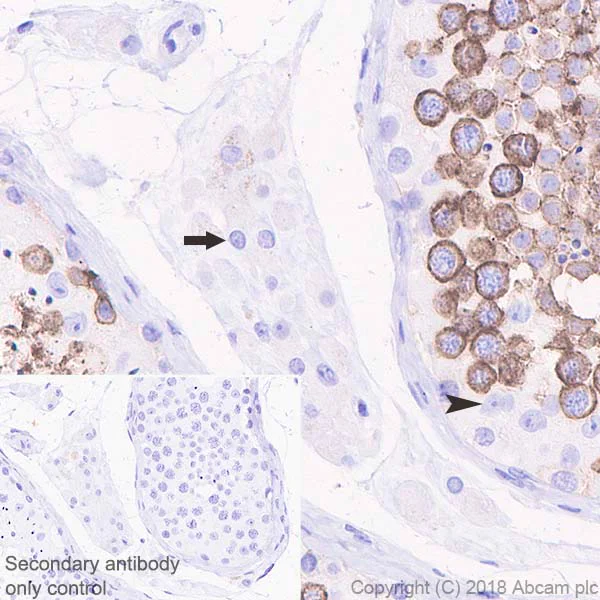 Immunohistochemistry (Formalin/PFA-fixed paraffin-embedded sections) - Anti-DPEP3 antibody [EPR21862] - BSA and Azide free (AB238646)