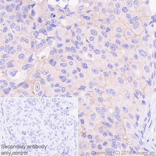 Immunohistochemistry (Formalin/PFA-fixed paraffin-embedded sections) - Anti-DPEP3 antibody [EPR21862] - BSA and Azide free (AB238646)