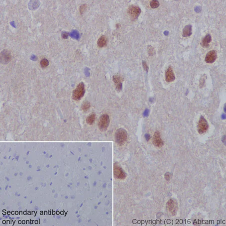 Immunohistochemistry (Formalin/PFA-fixed paraffin-embedded sections) - Anti-DPF2/REQ antibody [EPR9206(B)] - BSA and Azide free (AB232327)