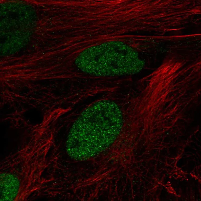 Immunocytochemistry/ Immunofluorescence - Anti-DPF3 antibody (AB254980)