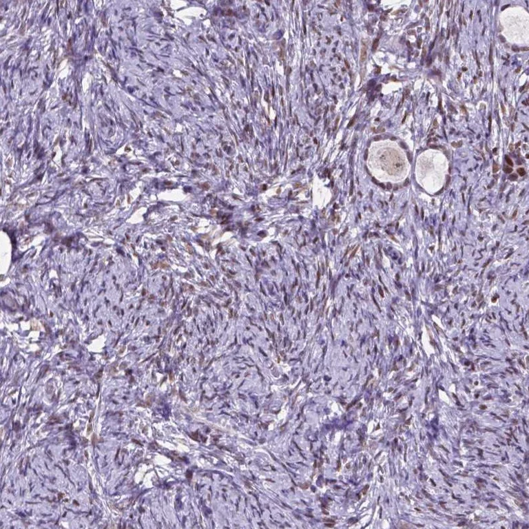 Immunohistochemistry (Formalin/PFA-fixed paraffin-embedded sections) - Anti-DPF3 antibody (AB254980)
