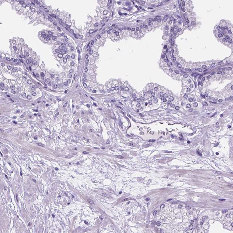 Immunohistochemistry (Formalin/PFA-fixed paraffin-embedded sections) - Anti-DPF3 antibody (AB254980)