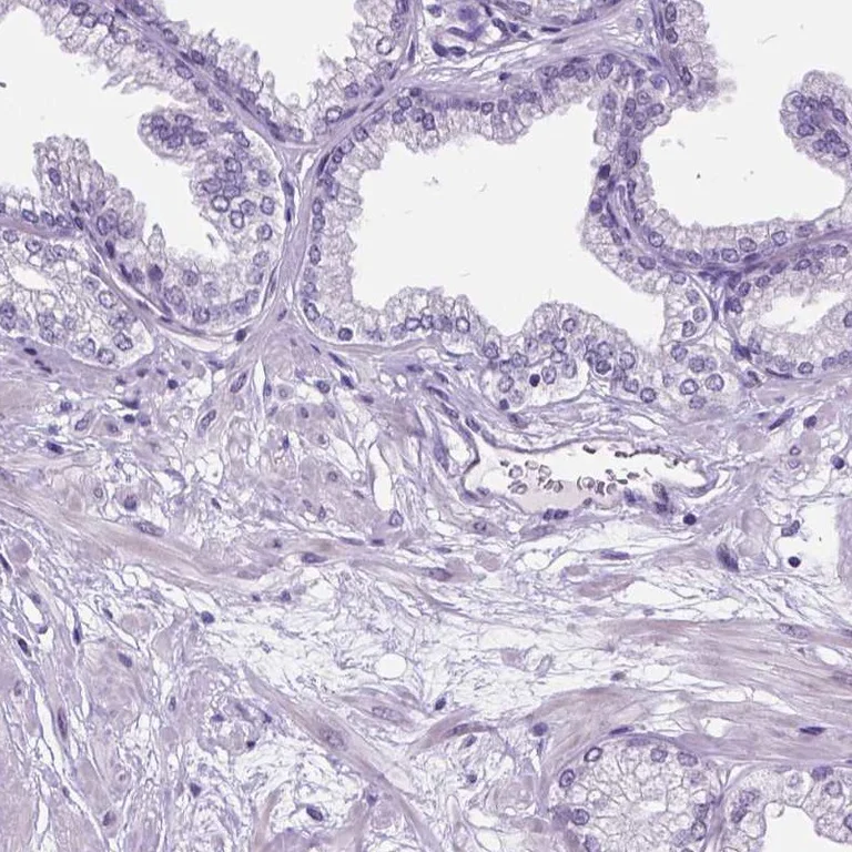 Immunohistochemistry (Formalin/PFA-fixed paraffin-embedded sections) - Anti-DPF3 antibody (AB254980)