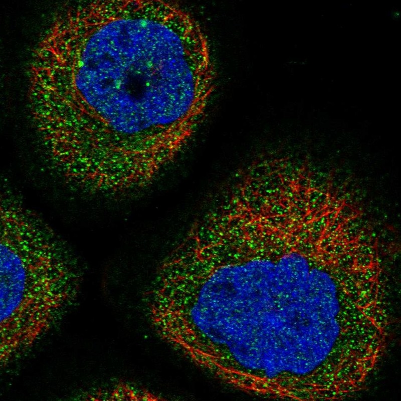 Immunocytochemistry/ Immunofluorescence - Anti-DPH4 antibody (AB246925), expandable thumbnail