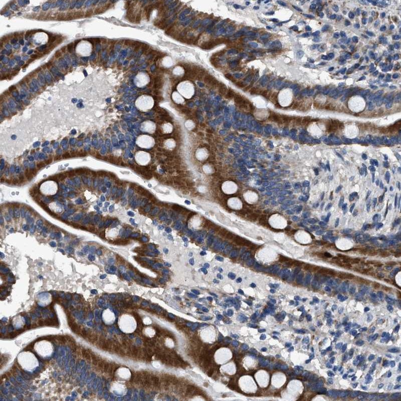 Immunohistochemistry (Formalin/PFA-fixed paraffin-embedded sections) - Anti-DPH4 antibody (AB246925), expandable thumbnail