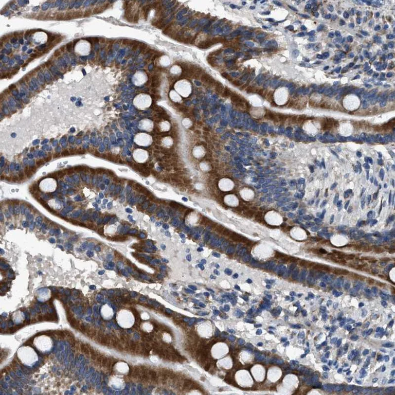 Immunohistochemistry (Formalin/PFA-fixed paraffin-embedded sections) - Anti-DPH4 antibody (AB246925)