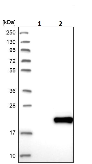 Western blot - Anti-DPH4 antibody (AB246925), expandable thumbnail