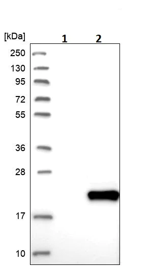 Western blot - Anti-DPH4 antibody (AB246925)