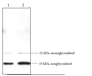 Western blot - Anti-DPL antibody (AB23701)