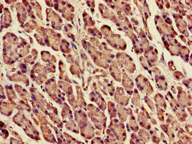 Immunohistochemistry (Formalin/PFA-fixed paraffin-embedded sections) - Anti-DPM1 antibody (AB236604)
