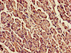 Immunohistochemistry (Formalin/PFA-fixed paraffin-embedded sections) - Anti-DPM1 antibody (AB236604)