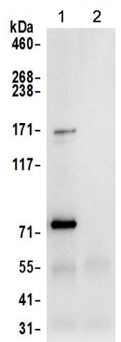 Immunoprecipitation - Anti-DPP3 antibody (AB217127)