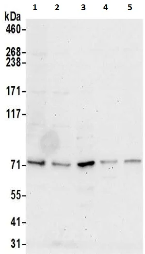 Western blot - Anti-DPP3 antibody (AB217127)