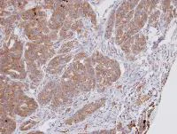 Immunohistochemistry (Formalin/PFA-fixed paraffin-embedded sections) - Anti-DPP3 antibody (AB97437)