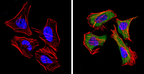 Immunocytochemistry/ Immunofluorescence - Anti-DPP4 antibody [236.3] (AB119346), expandable thumbnail