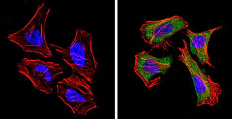 Immunocytochemistry/ Immunofluorescence - Anti-DPP4 antibody [236.3] (AB119346)