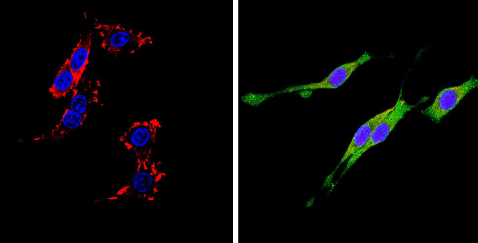 Immunocytochemistry/ Immunofluorescence - Anti-DPP4 antibody [236.3] (AB119346), expandable thumbnail