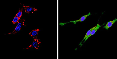 Immunocytochemistry/ Immunofluorescence - Anti-DPP4 antibody [236.3] (AB119346)