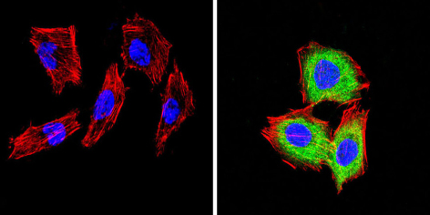 Immunocytochemistry/ Immunofluorescence - Anti-DPP4 antibody [236.3] (AB119346), expandable thumbnail