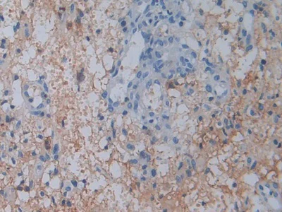 Immunohistochemistry (Formalin/PFA-fixed paraffin-embedded sections) - Anti-DPP4 antibody (AB231973)