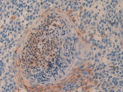 Immunohistochemistry (Formalin/PFA-fixed paraffin-embedded sections) - Anti-DPP4 antibody (AB231973)