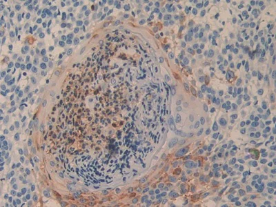 Immunohistochemistry (Formalin/PFA-fixed paraffin-embedded sections) - Anti-DPP4 antibody (AB231973)