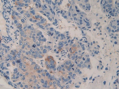 Immunohistochemistry (Formalin/PFA-fixed paraffin-embedded sections) - Anti-DPP4 antibody (AB231973)
