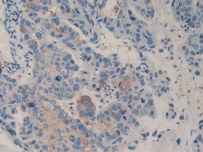 Immunohistochemistry (Formalin/PFA-fixed paraffin-embedded sections) - Anti-DPP4 antibody (AB231973)