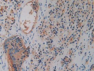 Immunohistochemistry (Formalin/PFA-fixed paraffin-embedded sections) - Anti-DPP4 antibody (AB231973)
