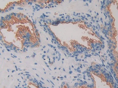 Immunohistochemistry (Formalin/PFA-fixed paraffin-embedded sections) - Anti-DPP4 antibody (AB231973)