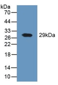 Western blot - Anti-DPP4 antibody (AB231973)