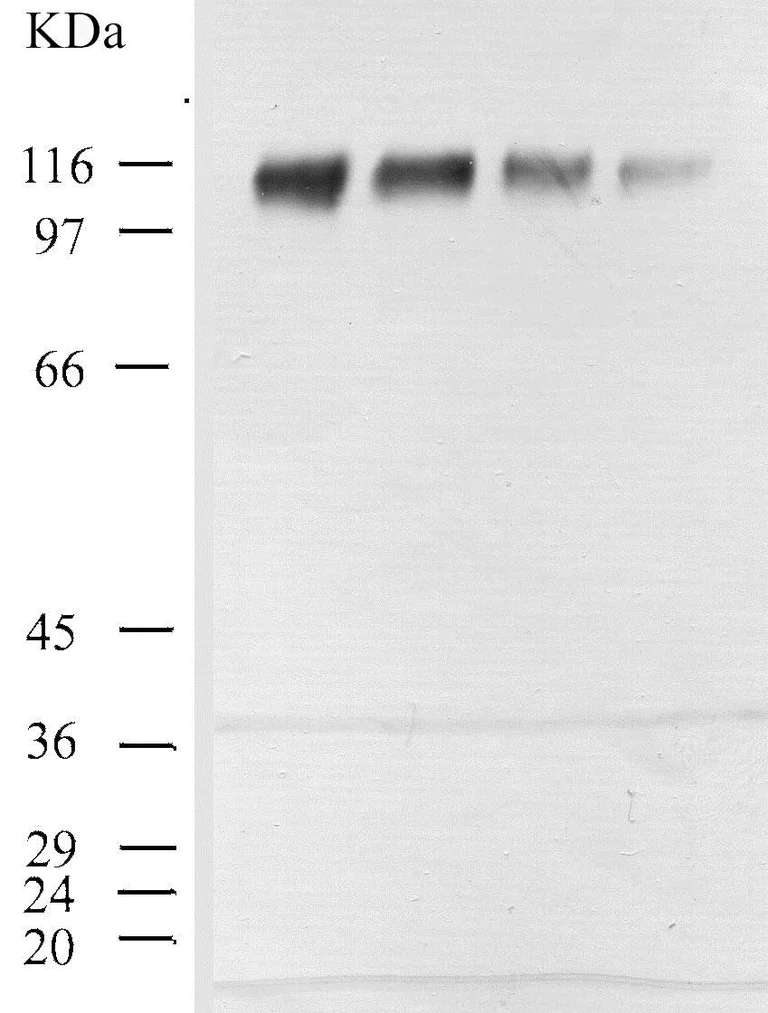 Western blot - Anti-DPP4 antibody (AB28340)