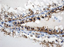 Immunohistochemistry (Formalin/PFA-fixed paraffin-embedded sections) - Anti-DPP4 antibody (AB61825)