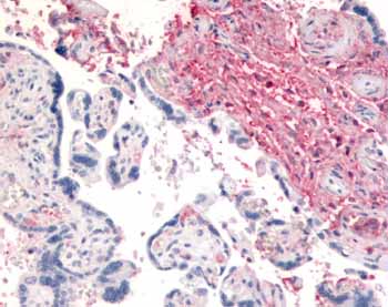Immunohistochemistry (Formalin/PFA-fixed paraffin-embedded sections) - Anti-DPP4 antibody (AB61825)