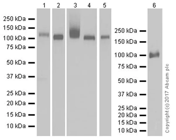 Western blot - Anti-DPP4 antibody [EPR18215] (AB187048)