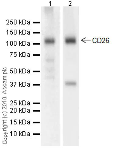 Western blot - Anti-DPP4 antibody [EPR21945] (AB222716)