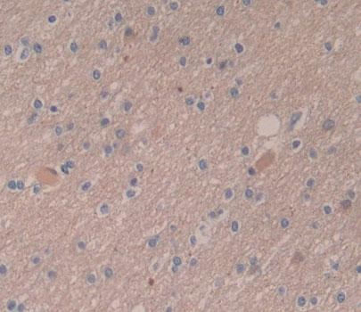 Immunohistochemistry (Formalin/PFA-fixed paraffin-embedded sections) - Anti-DPP6 antibody (AB232722)