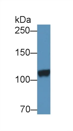 Western blot - Anti-DPP6 antibody (AB232722)