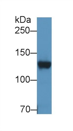 Western blot - Anti-DPP6 antibody (AB232722)