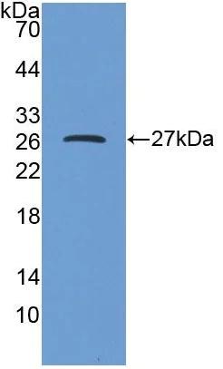 Western blot - Anti-DPP6 antibody (AB232722)
