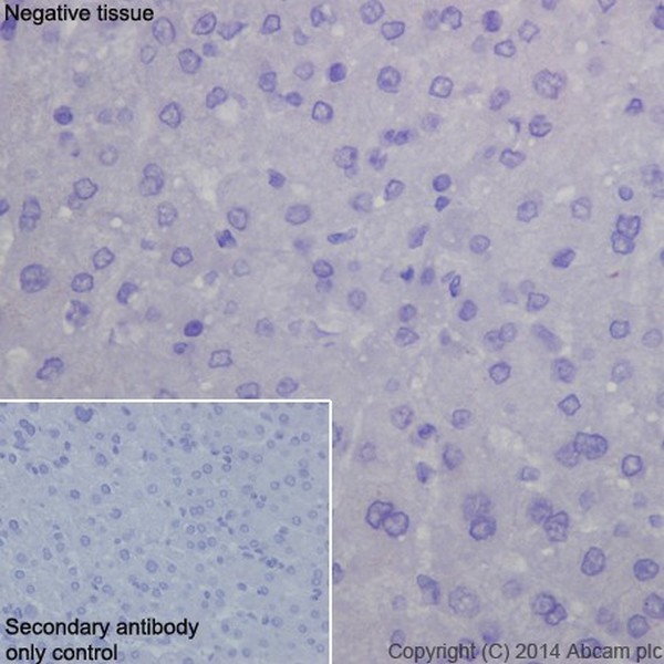 Immunohistochemistry (Formalin/PFA-fixed paraffin-embedded sections) - Anti-DPP6 antibody [EPR15944-24] (AB198506), expandable thumbnail
