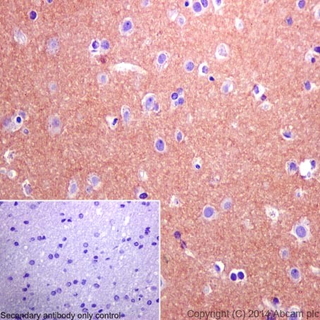 Immunohistochemistry (Formalin/PFA-fixed paraffin-embedded sections) - Anti-DPP6 antibody [EPR15944-24] (AB198506), expandable thumbnail