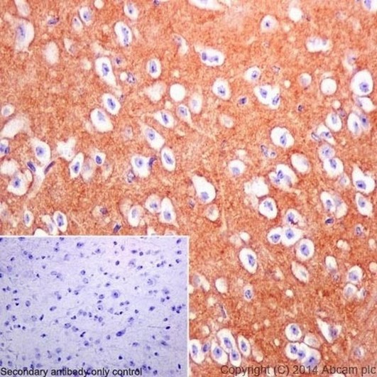 Immunohistochemistry (Formalin/PFA-fixed paraffin-embedded sections) - Anti-DPP6 antibody [EPR15944-24] (AB198506), expandable thumbnail