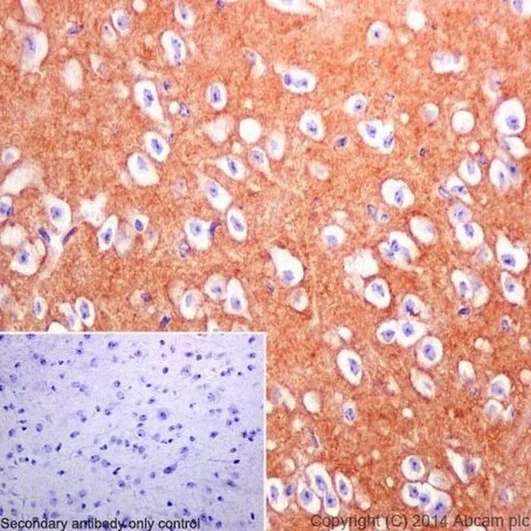 Immunohistochemistry (Formalin/PFA-fixed paraffin-embedded sections) - Anti-DPP6 antibody [EPR15944-24] (AB198506)