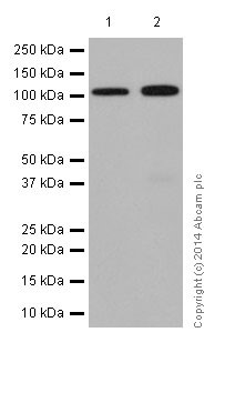 Western blot - Anti-DPP6 antibody [EPR15944-24] (AB198506), expandable thumbnail