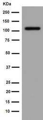 Western blot - Anti-DPP6 antibody [EPR15944] - BSA and Azide free (AB251074), expandable thumbnail