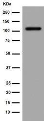 Western blot - Anti-DPP6 antibody [EPR15944] - BSA and Azide free (AB251074)